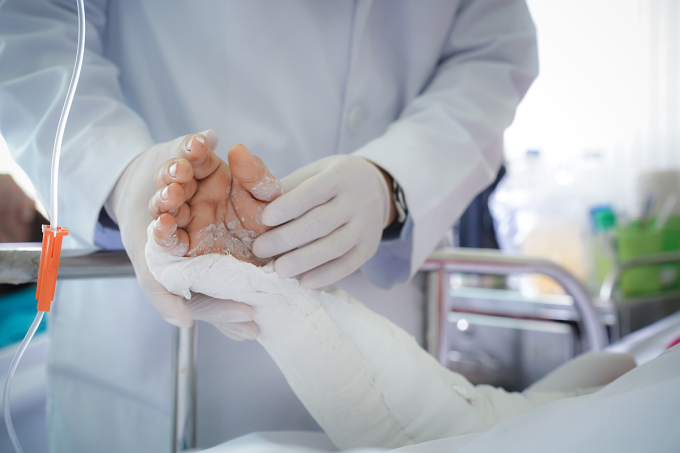 Vết thương vùng tay của bệnh nhân sau khi được xử trí.